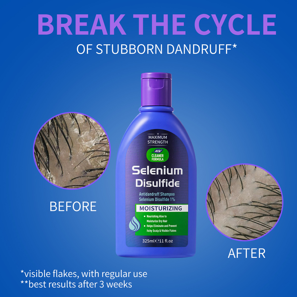 325ml セレン二硫化物配合 ふけ防止シャンプー 保湿ケア - Hair Care Dandruff のレビューと価格